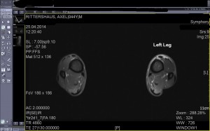 MRI 3comment